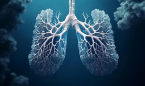 سرطان ریه - تکنوین